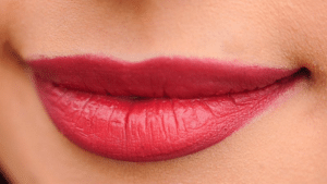 Corner Lip Lift