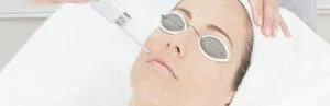 laser-acne-scar-removal