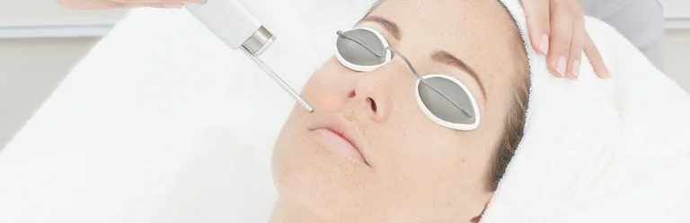 laser-acne-scar-removal