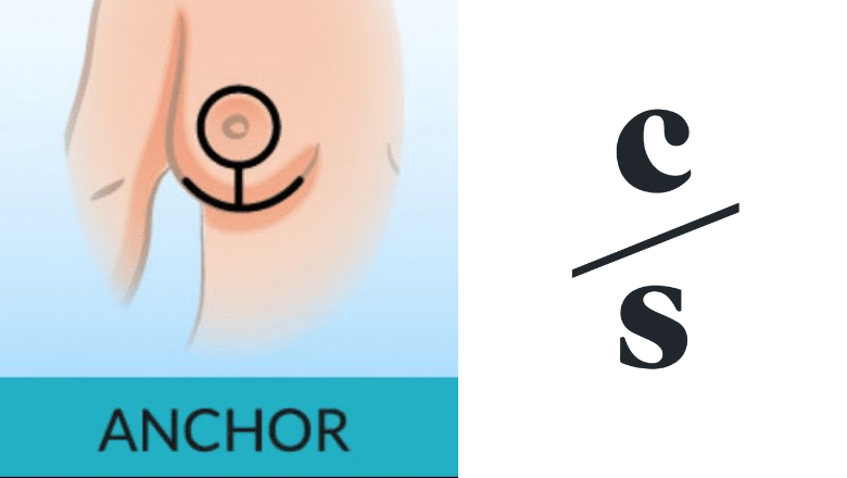 Anchor Incision Pattern Breast Reduction Mammoplasty London | Centre for Surgery