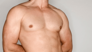 What Does Gynecomastia Feel Like
