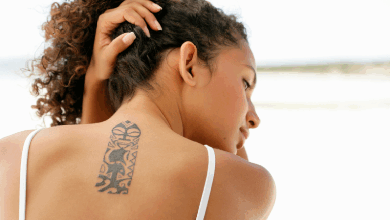 Is Surgical Tattoo Removal Better Than Laser