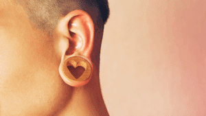 Can Stretched Earlobes from Gauges Be Repaired with Surgery