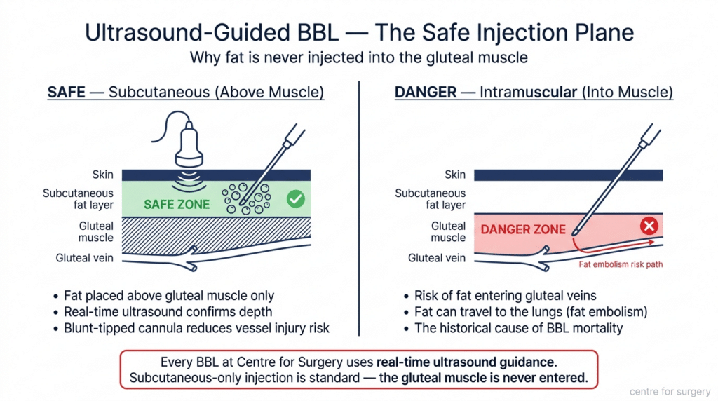 BBL Surgery London | Brazilian Butt Lift | Centre for Surgery