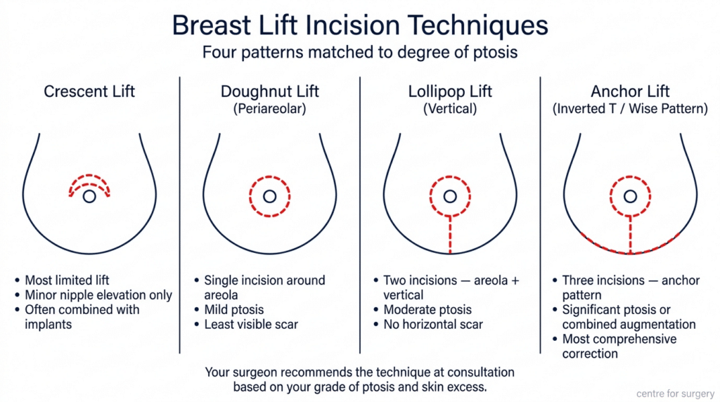 Anchor Incision Pattern Breast Lift London - Mastopexy & Uplift UK | Centre for Surgery