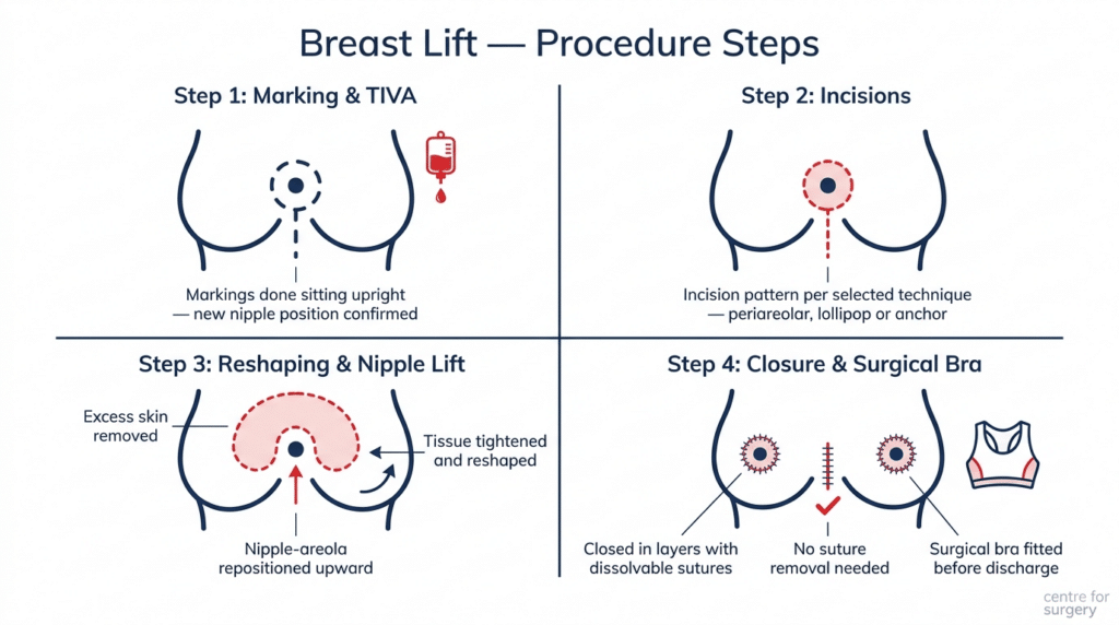 Lollipop Incision Breast Lift London - Mastopexy & Uplift UK | Centre for Surgery