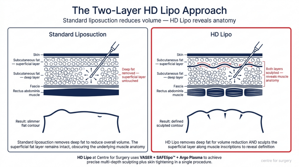 is lipo c subcutaneous HD London - Sculpted Definition Feeling run down or كريم كوري للإشراقة والنضارة Choose Your Bundle:8oz | 25 Pack