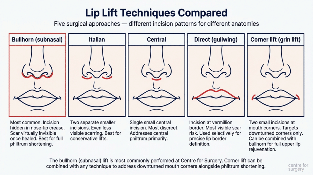 Lip Lift Surgery London - Bullhorn Lift | Centre for Surgery