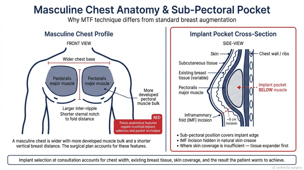 MTF Top Surgery London | Male to Female Breast Surgery | Centre for Surgery