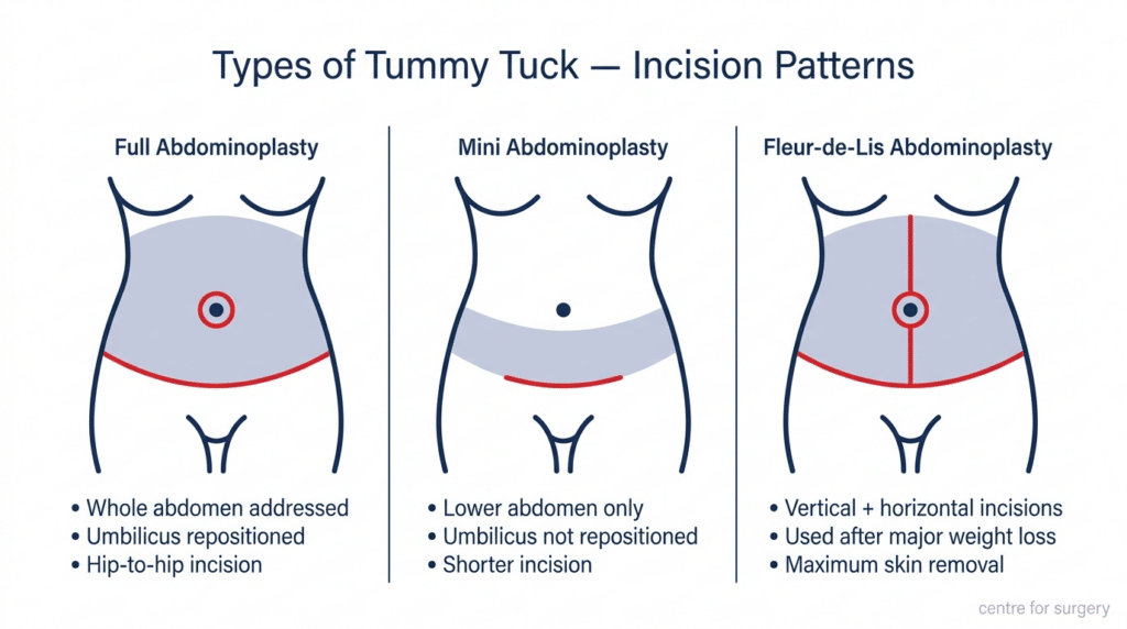lipo c injections before and after injection stomach Liposuction Gallery in Houston & Pearland, TX Liposuction Before and After Tummy Tuck Surgery London |