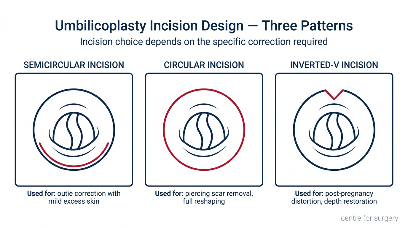 Umbilicoplasty London | Belly Button Surgery | Centre for Surgery