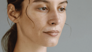 Three-quarter view portrait showing the nostril and alar rim — alar rim retraction assessment and correction, Centre for Surgery London