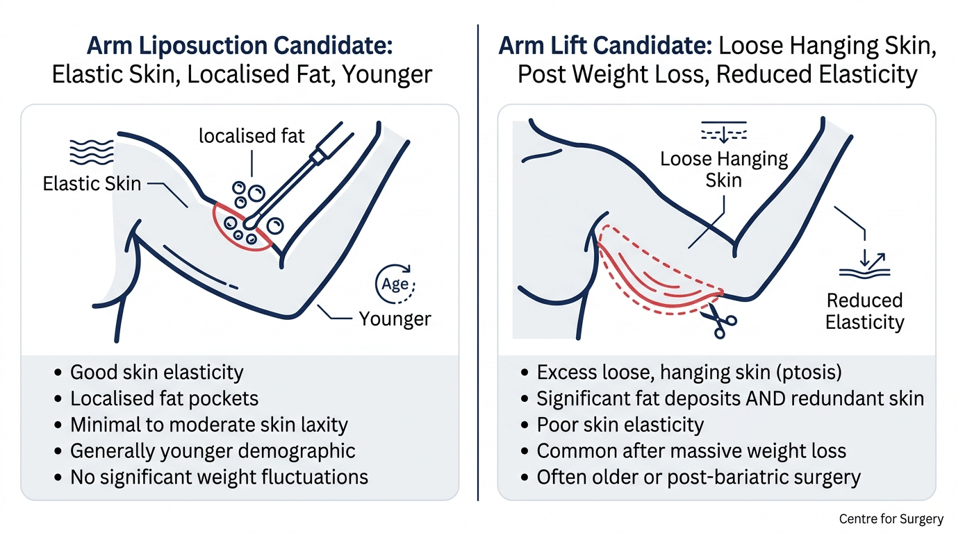 Candidacy criteria diagram comparing ideal candidates for arm liposuction versus arm lift at Centre for Surgery London