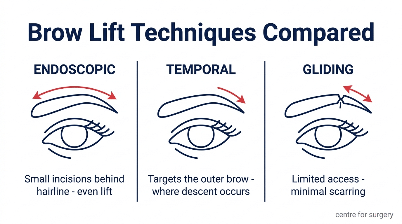Diagram comparing brow lift techniques — endoscopic brow lift for even lift via incisions behind the hairline, temporal brow lift targeting the outer third, and gliding brow lift with limited access and minimal scarring, Centre for Surgery London
