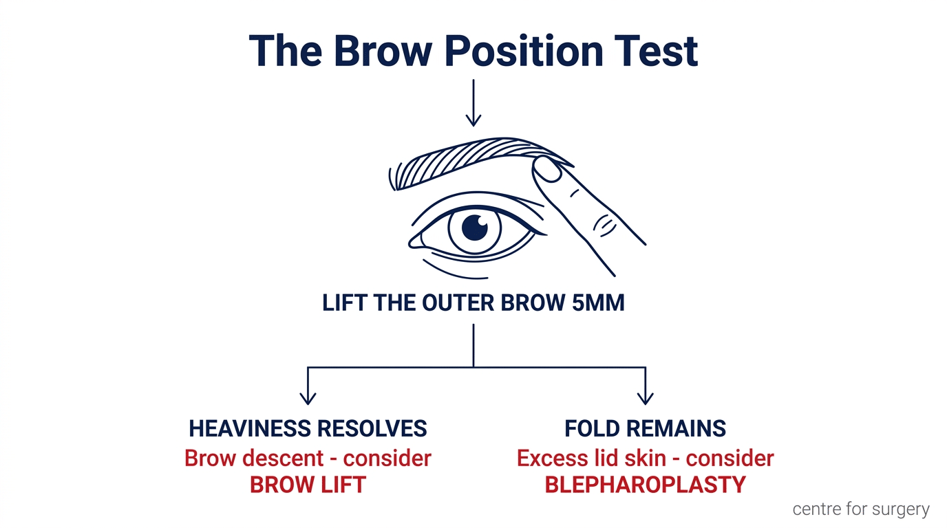 The brow position test diagram — lifting the outer eyebrow five millimetres, with two outcomes: heaviness resolves indicating brow descent and a brow lift, or the fold remains indicating excess eyelid skin and blepharoplasty, Centre for Surgery London