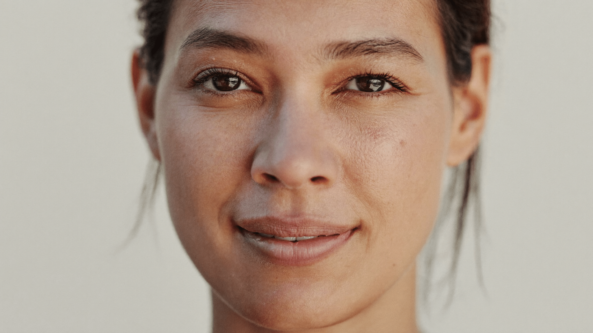 Woman in her early thirties in natural daylight with a relaxed, level-browed expression, showing the upper eyelid crease, lash line and both inner and outer eye corners: the anatomy that determines eye shape, Centre for Surgery London