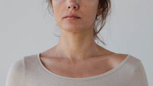 Front-facing portrait of a woman recovering after rhinoplasty — how long swelling lasts and the stages it follows, Centre for Surgery London