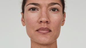 Front-facing portrait showing the nasal bridge — wide nose bridge assessment and treatment, Centre for Surgery London