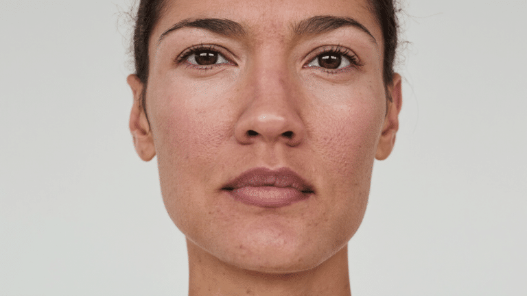 Front-facing portrait showing the nasal bridge — wide nose bridge assessment and treatment, Centre for Surgery London