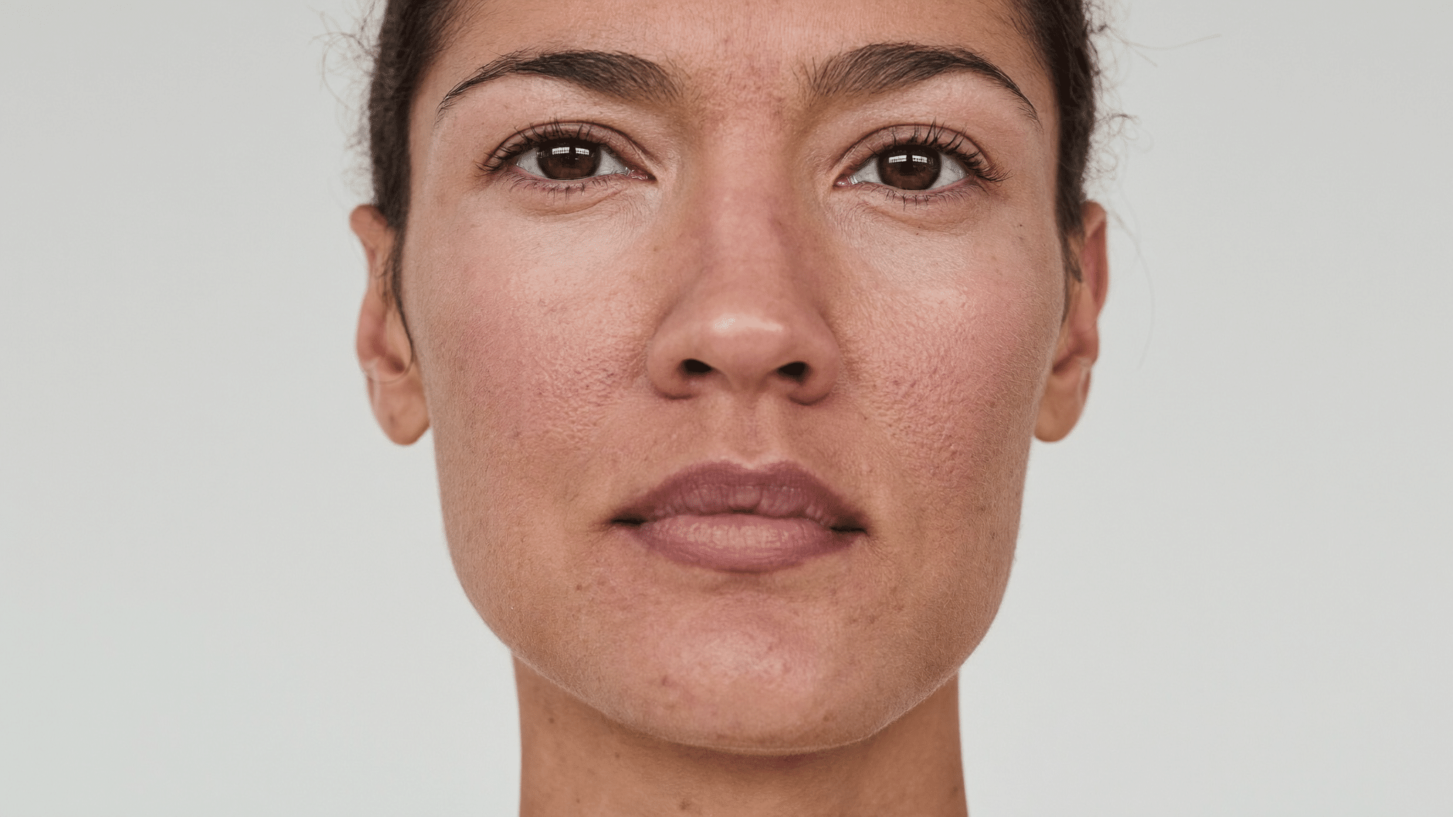 Front-facing portrait showing the nasal bridge — wide nose bridge assessment and treatment, Centre for Surgery London