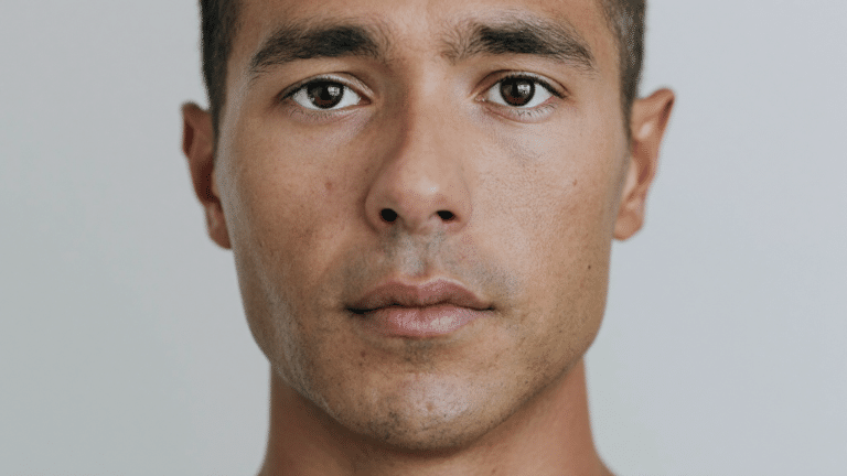 Front-facing portrait showing overall nose width — wide nose assessment and treatment options, Centre for Surgery London