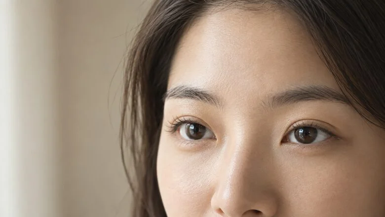 Natural, low double eyelid crease on East Asian upper lids — Asian blepharoplasty double eyelid surgery at Centre for Surgery, Baker Street, London