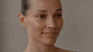 Woman in her late thirties with fine lines at the outer corner of the eye — crow's feet causes and treatment, Centre for Surgery London