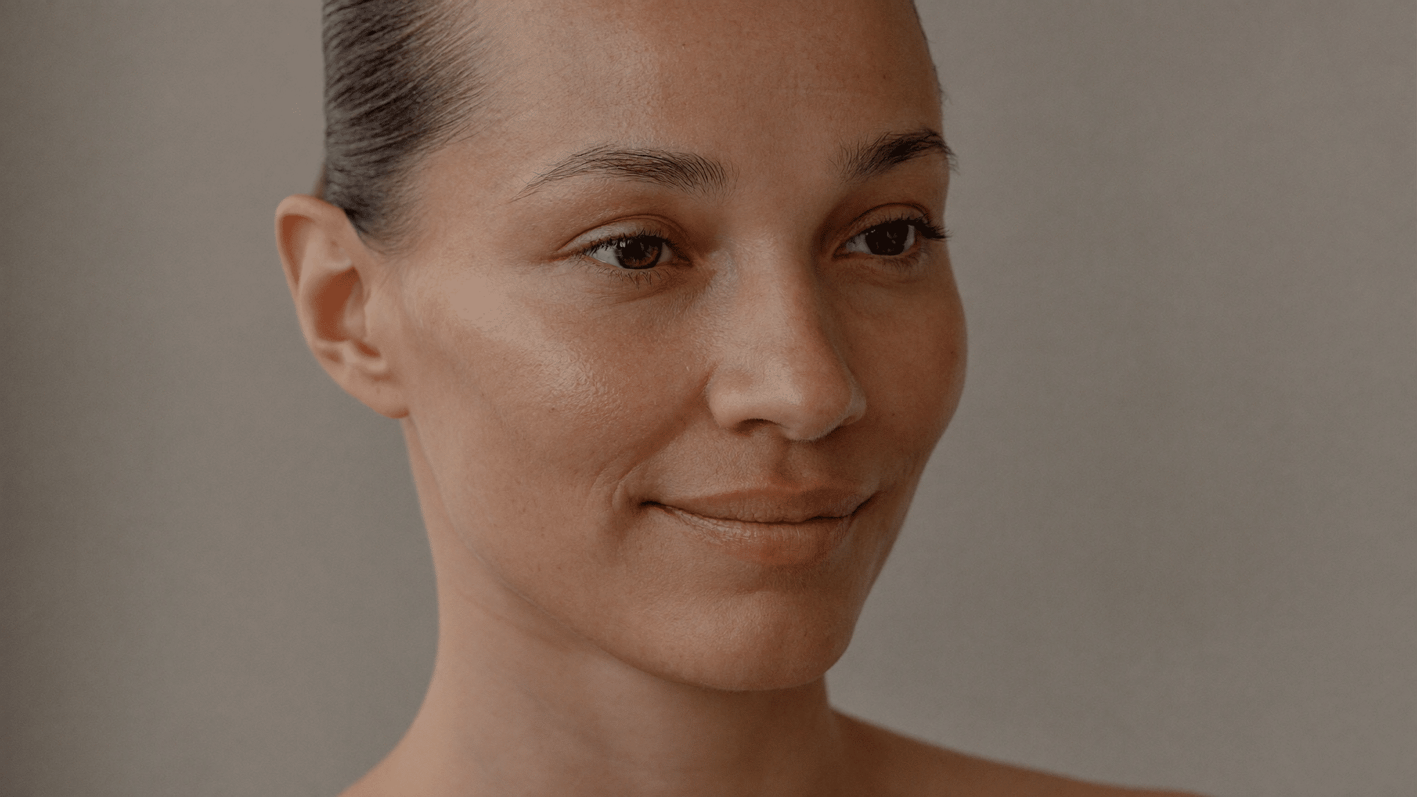 Woman in her late thirties with fine lines at the outer corner of the eye — crow's feet causes and treatment, Centre for Surgery London