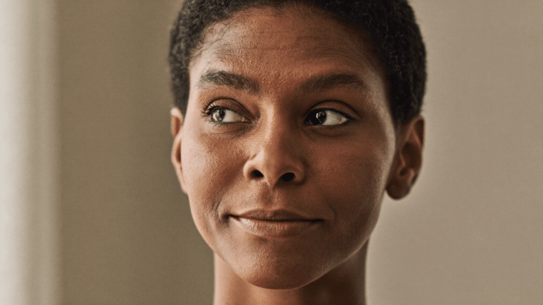Woman in her late thirties showing the area between the eyebrows — frown lines causes and treatment, Centre for Surgery London