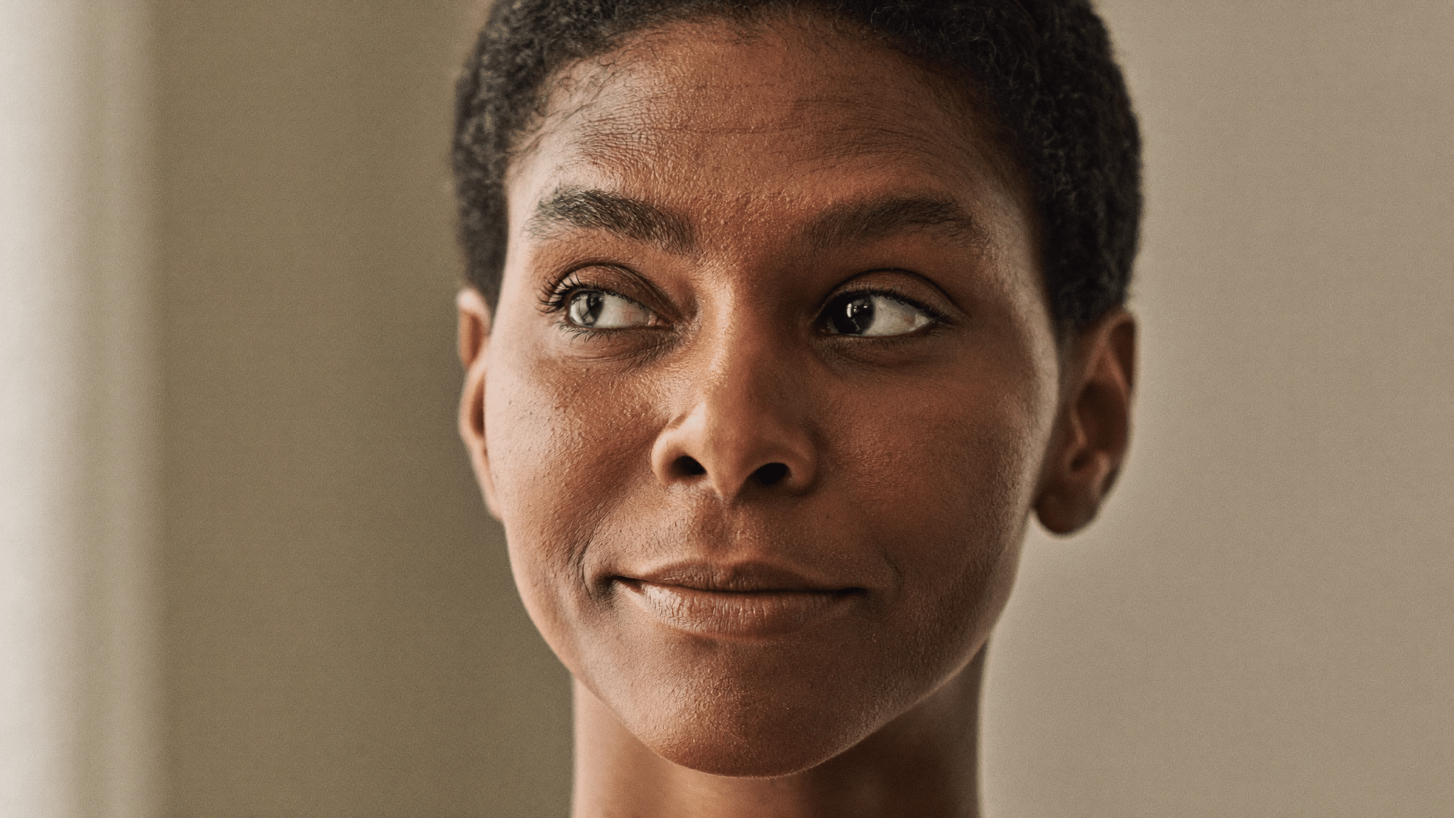 Woman in her late thirties showing the area between the eyebrows — frown lines causes and treatment, Centre for Surgery London