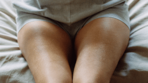 Close crop of a woman's thighs seated on a linen bed in soft window light, showing natural unretouched skin texture — illustrative image, not a patient photograph