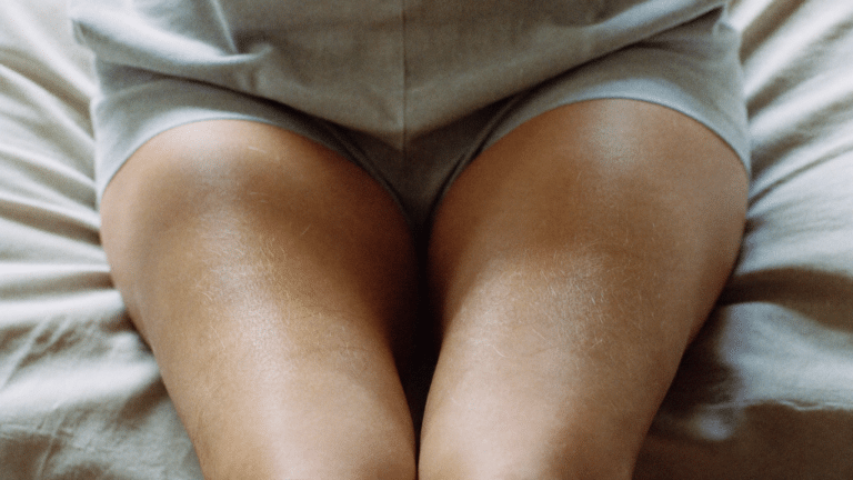 Close crop of a woman's thighs seated on a linen bed in soft window light, showing natural unretouched skin texture — illustrative image, not a patient photograph