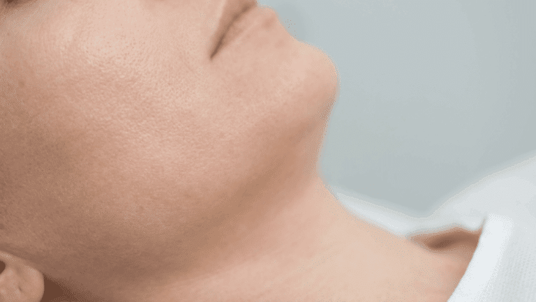 Close-up clinical photography of healthy skin — mole assessment at Centre for Surgery London