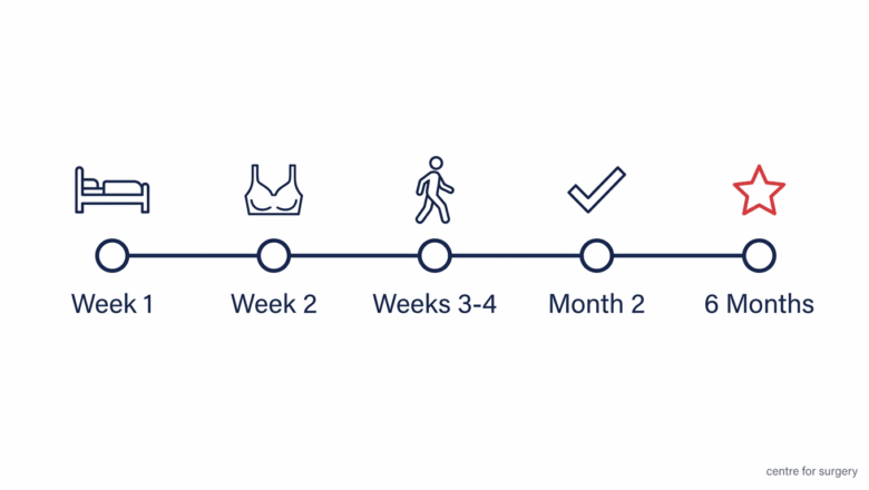 Breast augmentation recovery timeline diagram: week 1, week 2, weeks 3 to 4, month 2, and 6 months for full settling