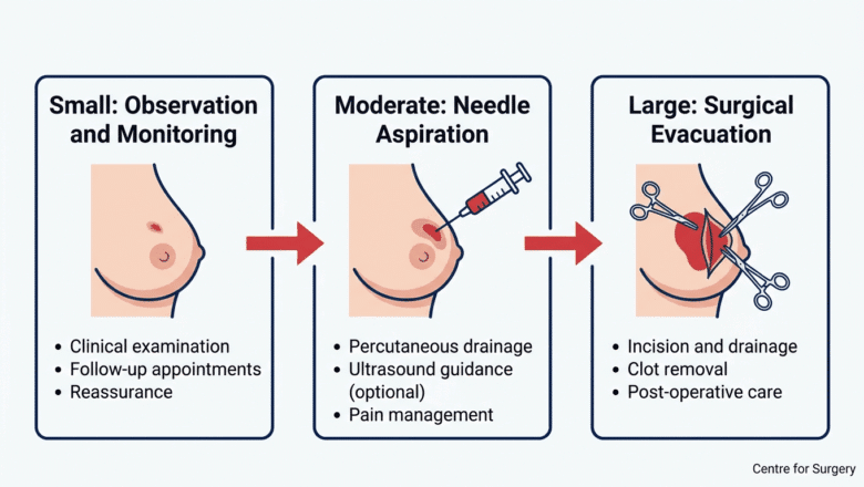 Decision pathway diagram showing breast haematoma treatment options by severity at Centre for Surgery London — observation, needle aspiration, surgical evacuation