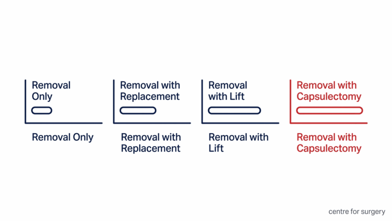 Diagram comparing recovery for breast implant removal only, removal with replacement, removal with lift, and removal with capsulectomy, at Centre for Surgery London