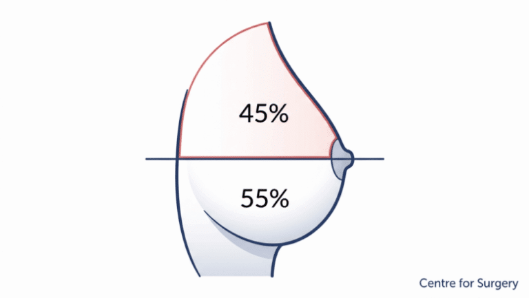 Diagram showing the commonly cited 45:55 breast proportion, with volume above and below the nipple, at Centre for Surgery London