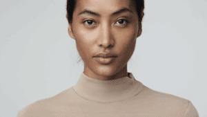 Front-facing portrait showing the nose tip — bulbous nose causes and treatment options, Centre for Surgery London