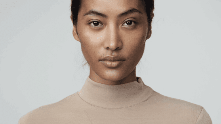Front-facing portrait showing the nose tip — bulbous nose causes and treatment options, Centre for Surgery London
