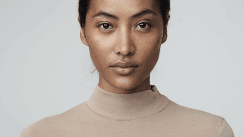 Front-facing portrait showing the nose tip — bulbous nose causes and treatment options, Centre for Surgery London