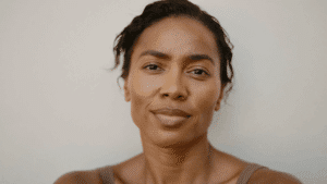 Woman with medium-brown skin showing natural under-eye shadowing — dark circles under eyes treatment at Centre for Surgery London
