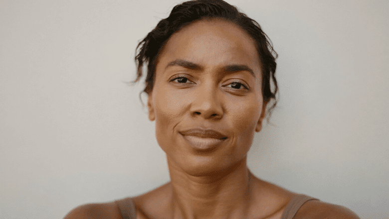 Woman with medium-brown skin showing natural under-eye shadowing — dark circles under eyes treatment at Centre for Surgery London