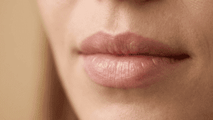 Close-up of natural female lips showing lip shape and definition — lip treatments at Centre for Surgery London