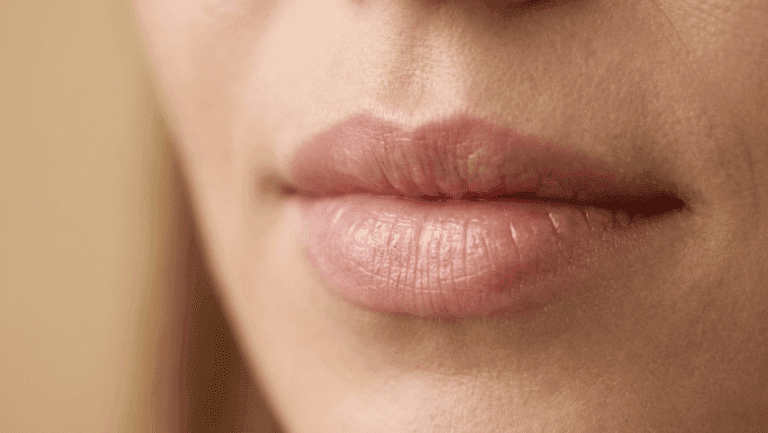 Close-up of natural female lips showing lip shape and definition — lip treatments at Centre for Surgery London
