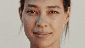 Woman in her early thirties in natural daylight with a relaxed, level-browed expression, showing the upper eyelid crease, lash line and both inner and outer eye corners — the anatomy that determines eye shape, Centre for Surgery London