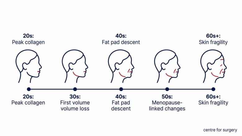 Horizontal timeline diagram showing facial ageing decade by decade from 20s through 60s plus, with the primary driver of visible change labelled at each stage: peak collagen, first volume loss, fat pad descent, menopause-linked changes, and skin fragility