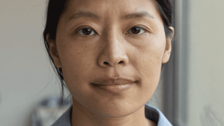 Close-up front-on portrait showing the nose and nostrils — flared nostrils, nostril width and alar base reduction, Centre for Surgery London