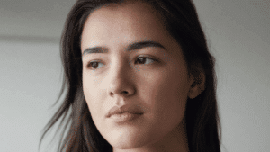 Woman in her early forties with fine horizontal lines across the forehead — forehead wrinkles causes and treatment, Centre for Surgery London