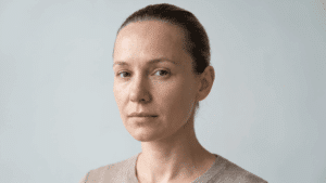 Hair swept back showing natural hairline position and forehead height, the proportions assessed in hairline lowering surgery at Centre for Surgery London