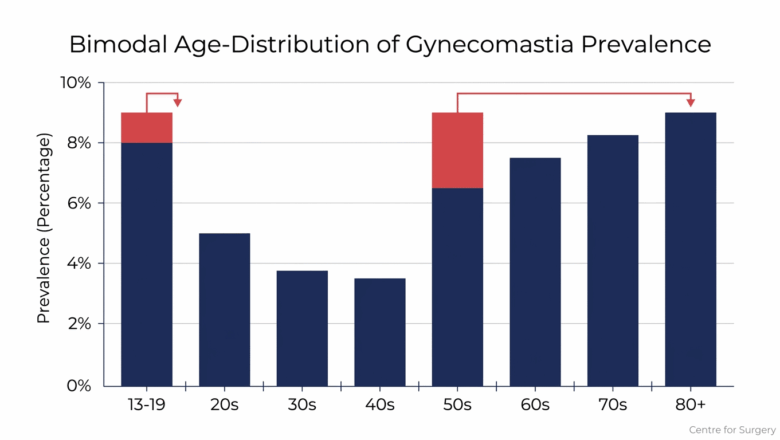 Bar chart showing bimodal age distribution of gynecomastia prevalence, peaking during puberty and again between ages 50 and 80